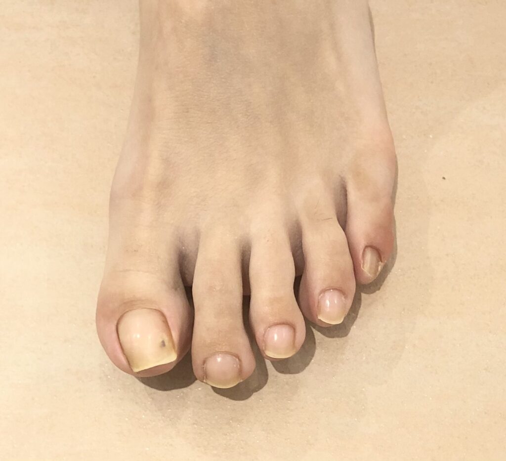 足の爪切りすぎてない 自宅での足の爪の切り方 えがお爪工房 シニア世代のためのネイルサロン 巣鴨